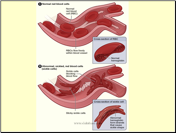 Haemoglobin S