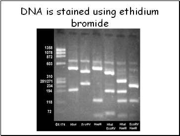 DNA is stained using ethidium bromide