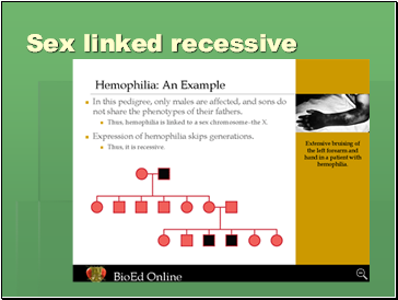 Sex linked recessive