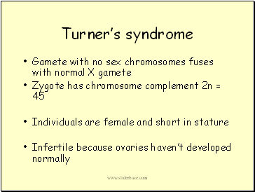 Turner’s syndrome