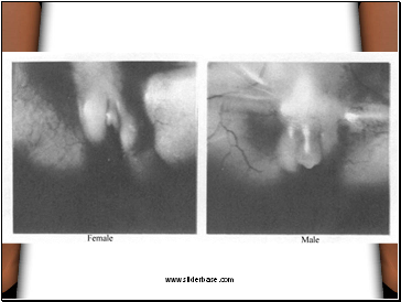 Everyone develops an area known as the urogenital ridge