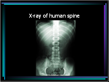 X-ray of human spine