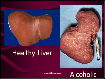 Liver Damage