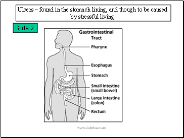 Ulcers