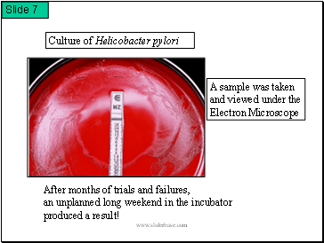 Culture of Helicobacter pylori