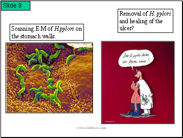 Removal of H. pylori