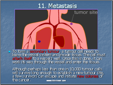 Metastasis