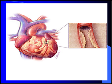 Cigarette Smoke and Disease