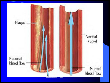 Cigarette Smoke and Disease