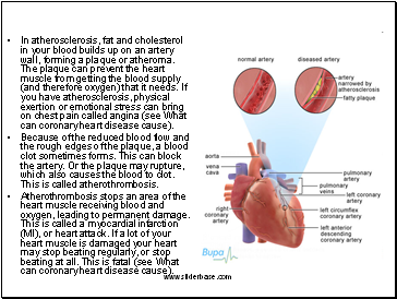 In atherosclerosis, fat and cholesterol in your blood builds up on an artery wall, forming a plaque or atheroma. The plaque can prevent the heart muscle from getting the blood supply (and therefore oxygen) that it needs. If you have atherosclerosis, physical exertion or emotional stress can bring on chest pain called angina (see What can coronary heart disease cause).