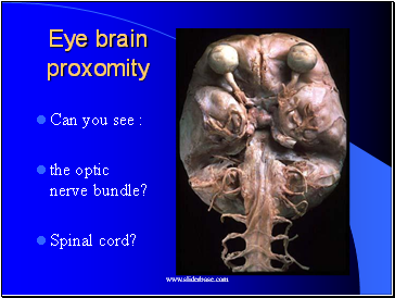 Eye brain proxomity