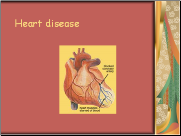 Heart disease