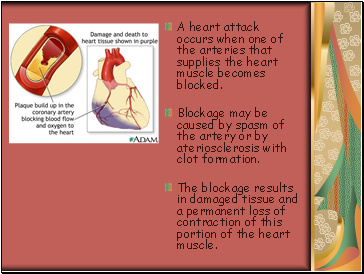 A heart attack occurs when one of the arteries that supplies the heart muscle becomes blocked.