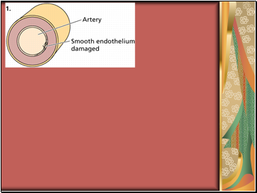 Heart disease arteriosclerosis