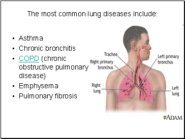 The most common lung diseases include: