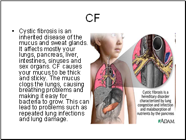 CF