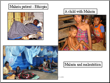 Malaria patient - Ethiopia