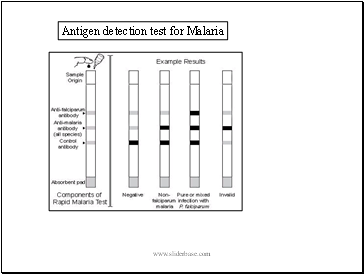 Antigen detection test for Malaria