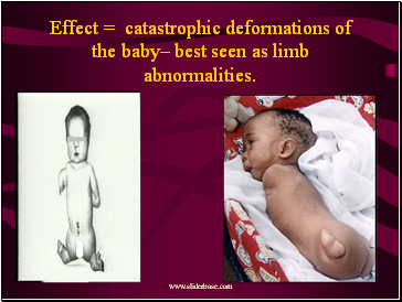 Effect = catastrophic deformations of the baby– best seen as limb abnormalities.