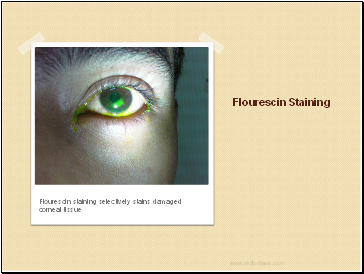 Flourescin Staining