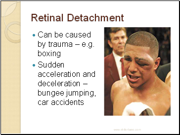 Retinal Detachment