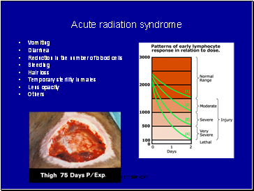 Acute radiation syndrome