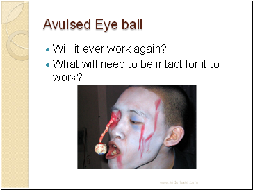 Avulsed Eye ball